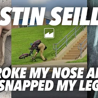 MERRITT BMX:  "I BROKE MY NOSE AND SNAPPED MY LEG"