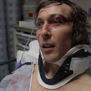 Brian Yeagle Speaks On Cracking His Skull